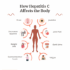 HCV Antibody Test Kit