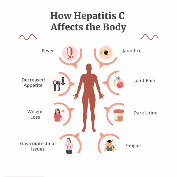 HCV Antibody Test Kit